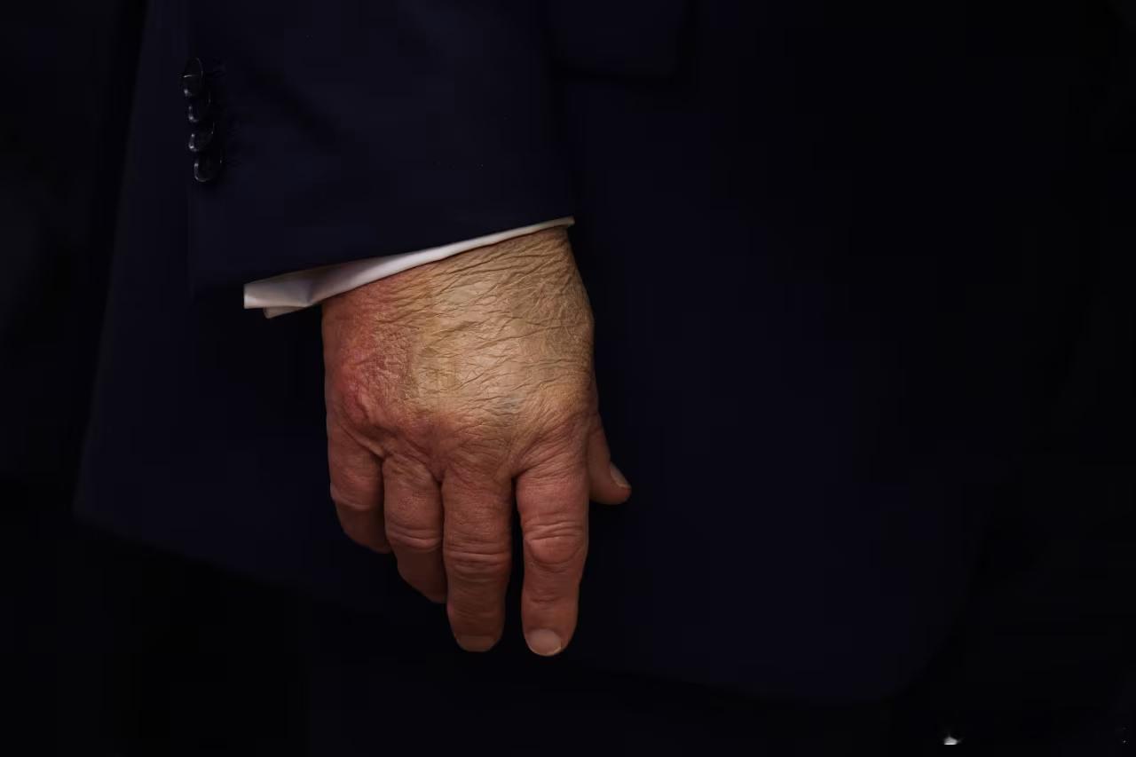 【特朗普称他不知道有传言称他死了】（CNN）特朗普表示，他不知道周末 在互联网上
