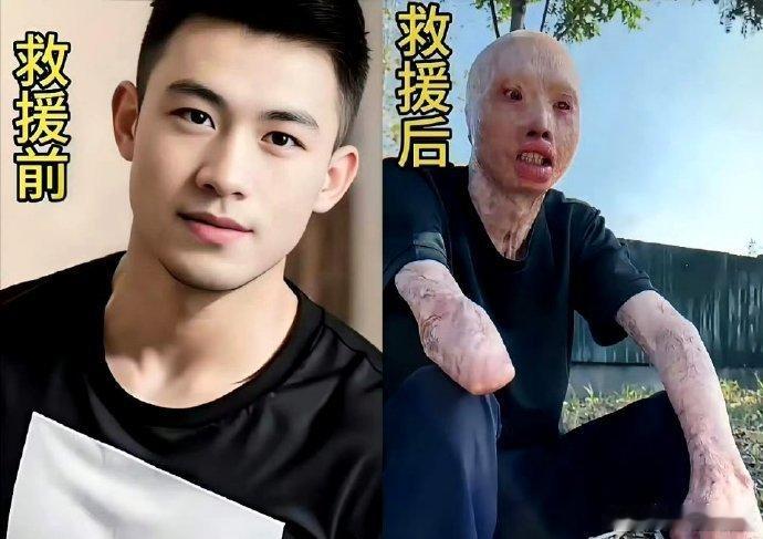 救火英雄救援前后照片对比，向救火英雄致敬🫡🫡 ​ ​​​
