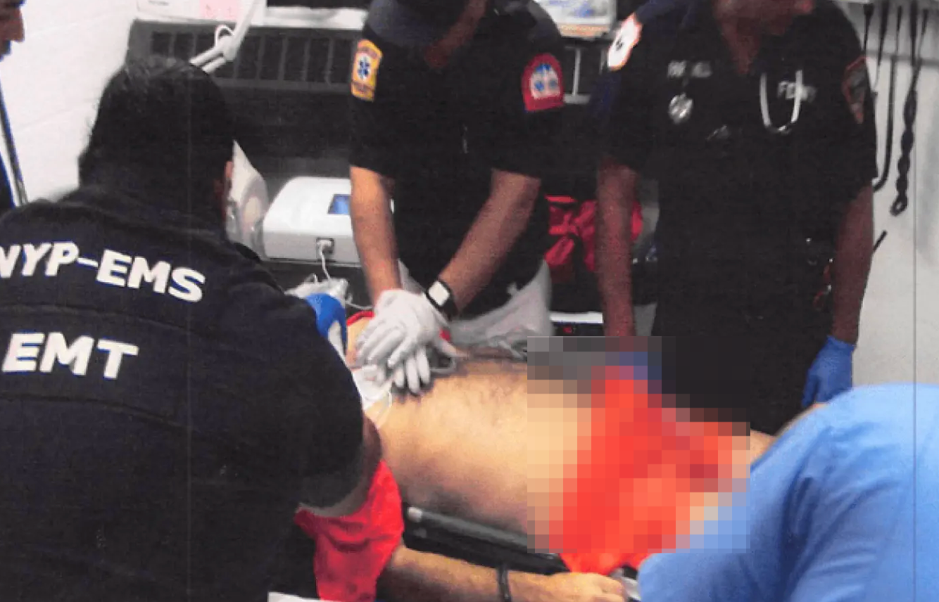 爱泼斯坦“自缢”后照片首度公开:脖子有血色勒痕,喉部甲状软骨