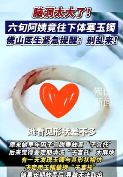 脑洞大开！广东佛山，一名65岁阿姨因为“阴道异物”去医院检查，结果医生检查时发现