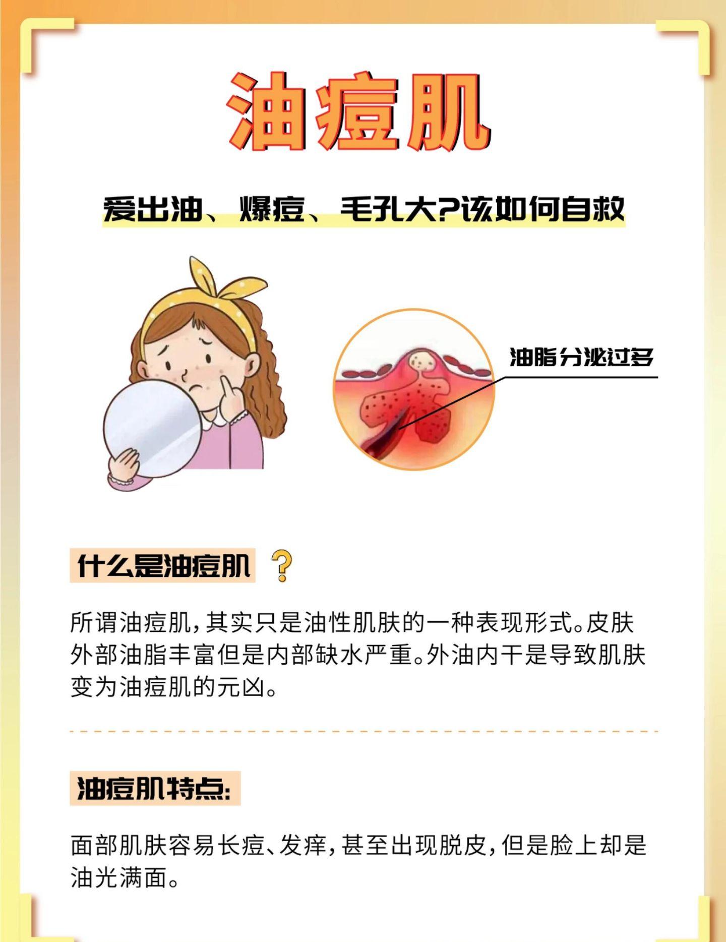 爱出油爆痘如何自救?油痘肌祛痘指南。痘痘肌拯救痘痘