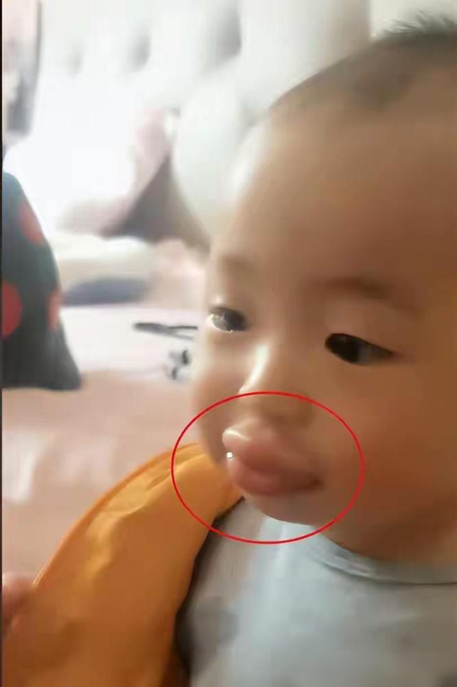 孩子嘴肿得像根香肠，妈妈没乱挤也没涂蒜，20分钟就稳住了。

真的得给这个妈妈点