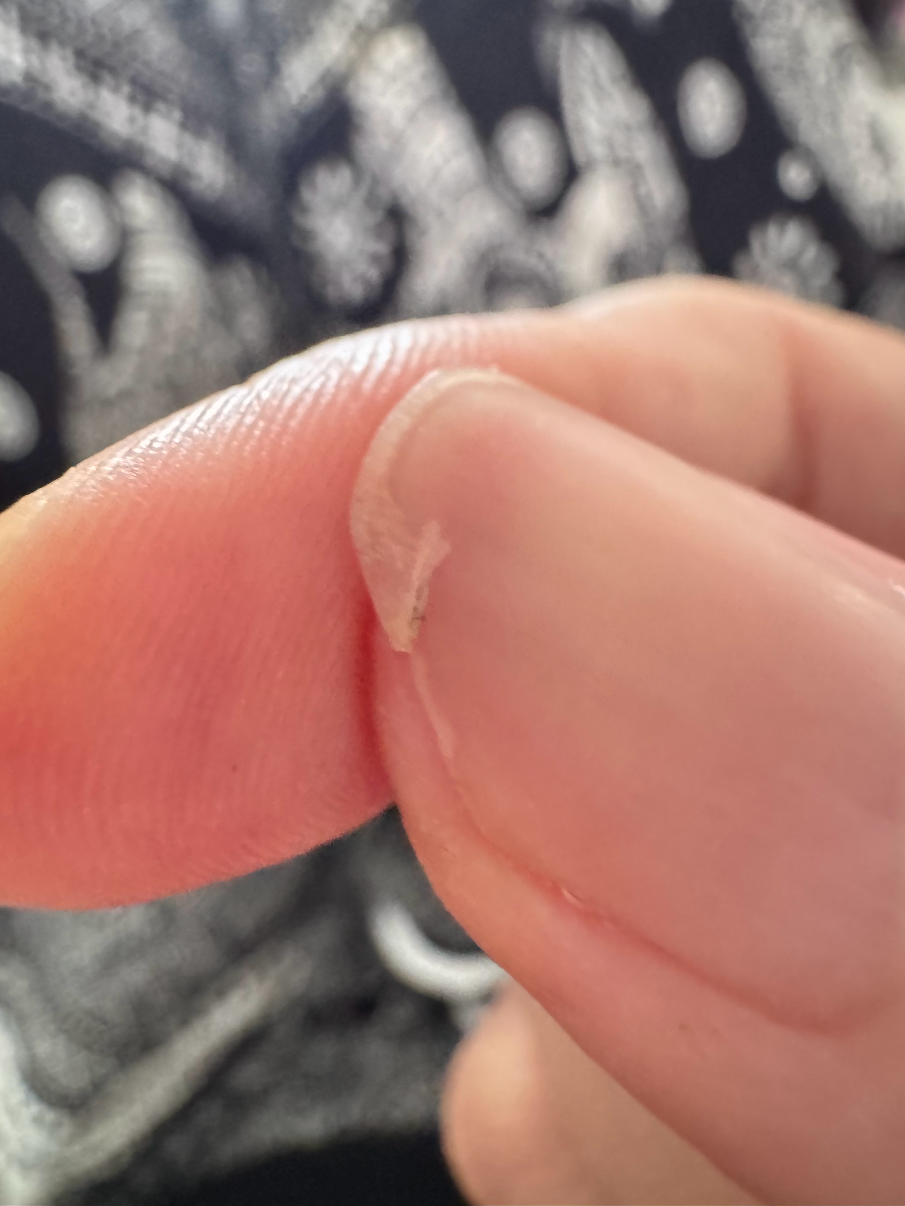 我的指甲太脆弱了，本来只是断一小截我就剪了，却没想到稍微用力一点都能让它越断越多