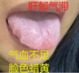 晚上睡不着，白天昏昏沉沉，行尸走肉一般
 
今天来的这个女孩，有家里人陪着，进门