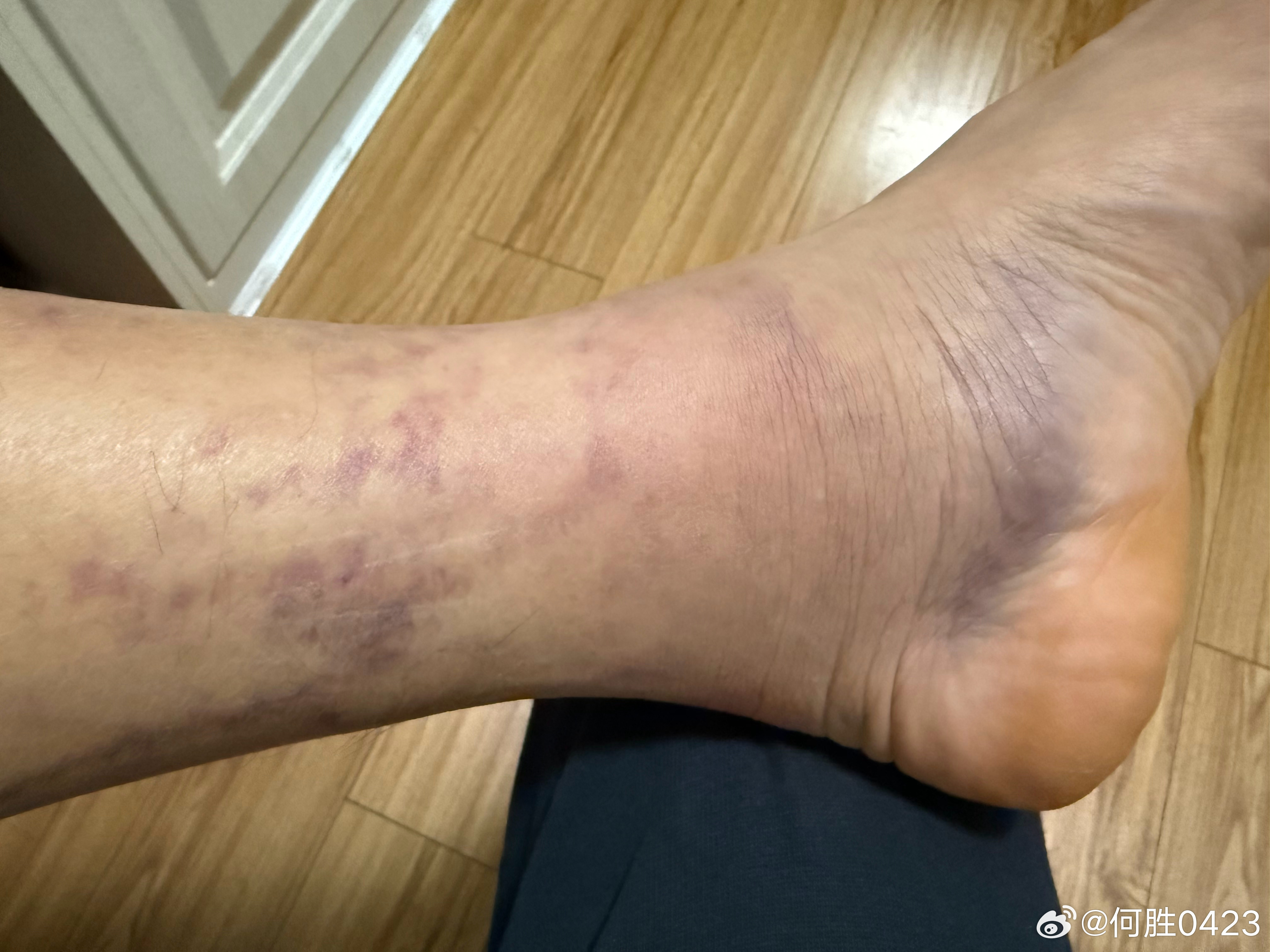 完犊子了，咋还变颜色了？ 