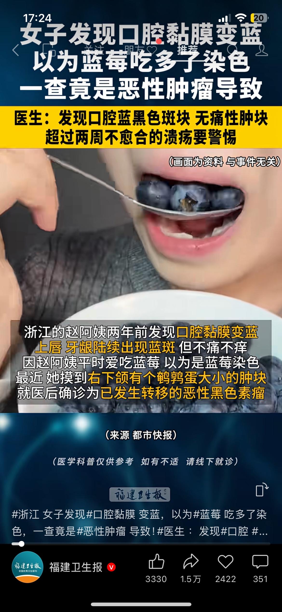 以为是蓝莓染色，结果是恶性肿瘤！口腔黏膜变蓝别大意
浙江一位女士发现口腔黏膜变蓝