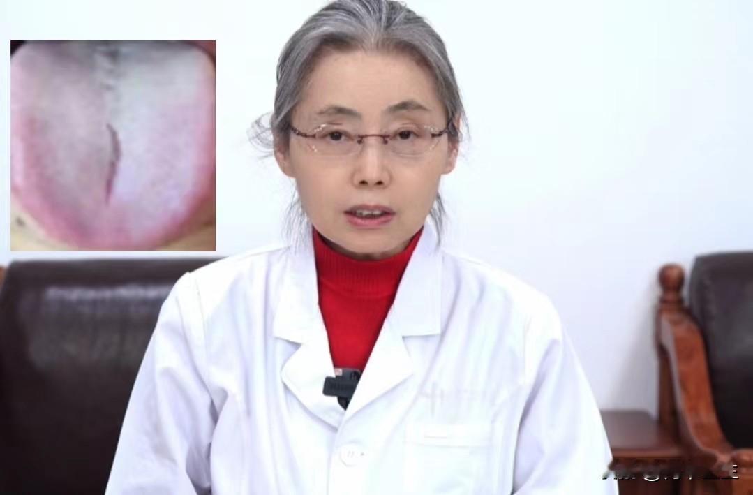像这种肝郁舌象，可别再用柴胡舒肝丸了，小心根本就不对症！

患者主诉：平时总感觉