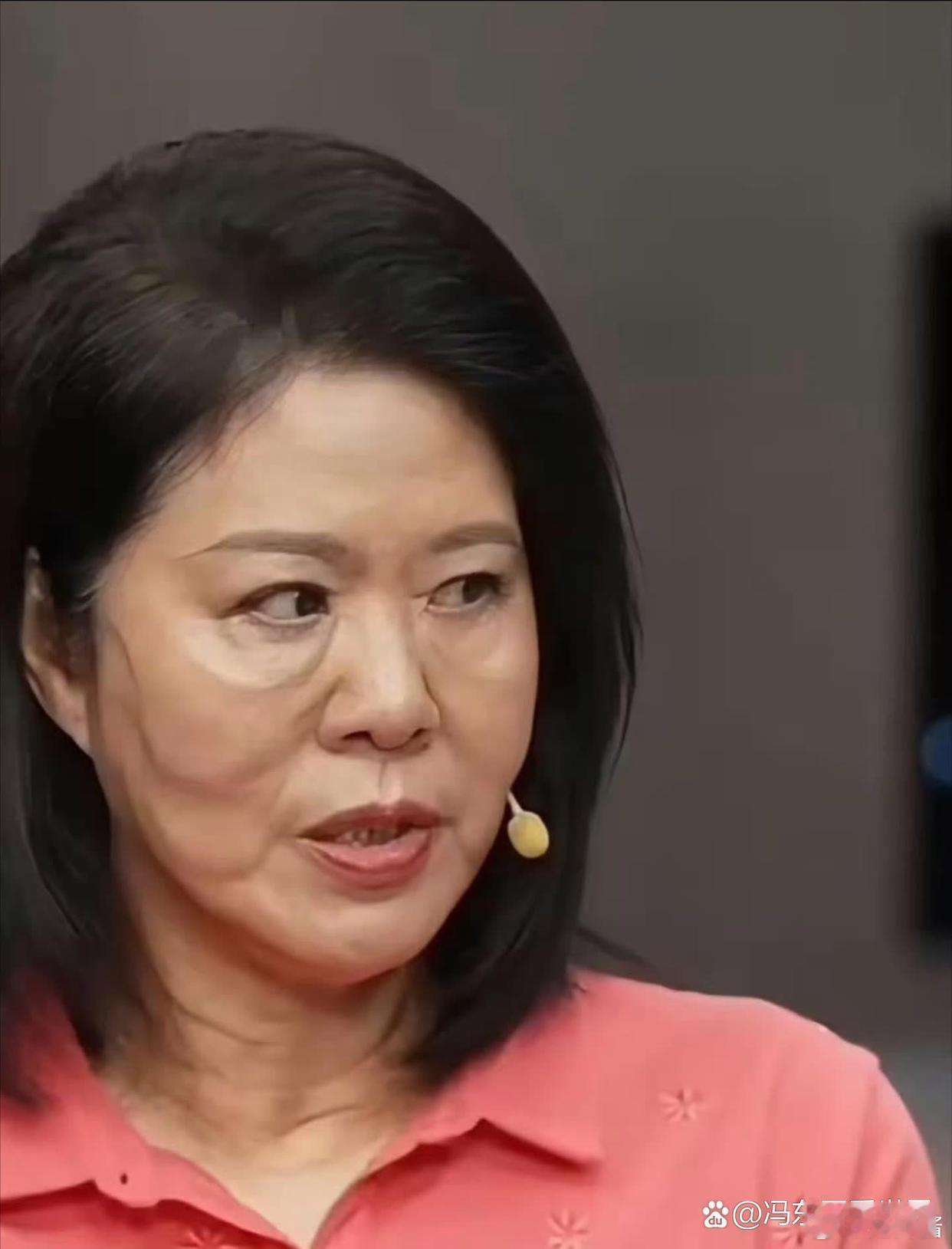 郎平的脸部凹凸不平，暴露出来医美的后遗症了。其实我觉得郎平不去医美，自然老去要比