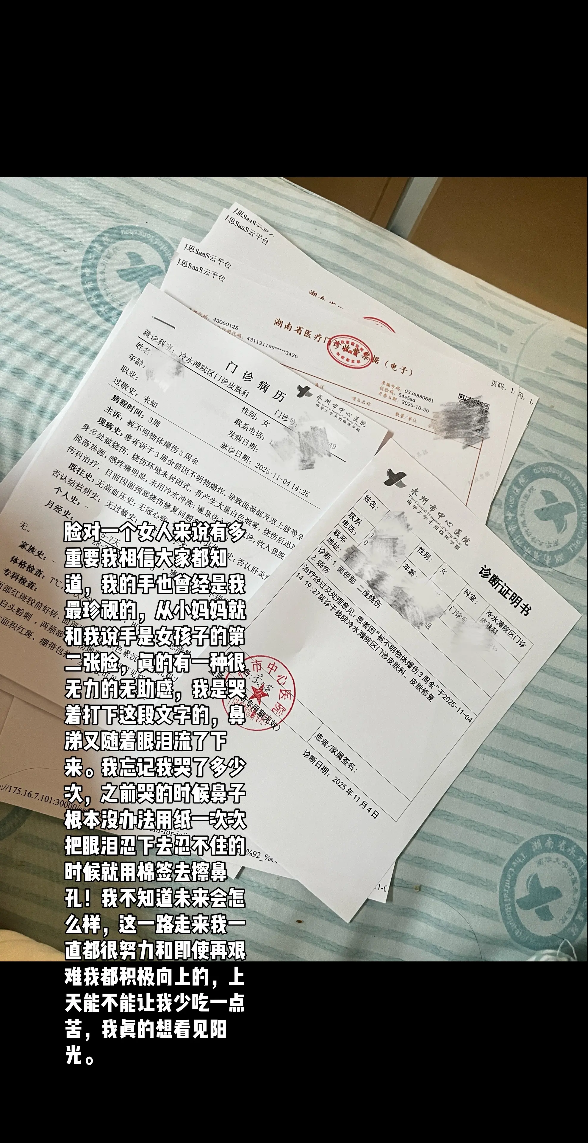 脸对一个女人来说有多重要我相信大家都知道，我的手也曾经是我最珍视的，从...