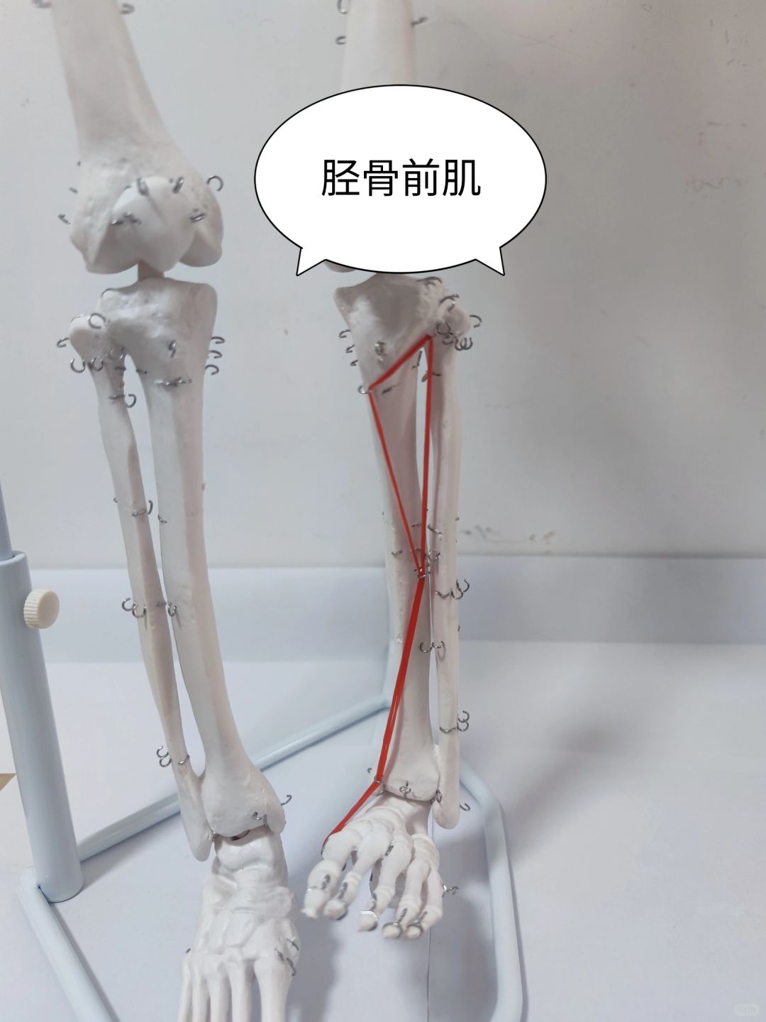 胫骨前肌