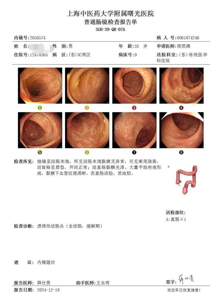 重视肠道cte和肠超在溃疡性结肠炎的应用。两位患者，都达到了溃疡性结肠...