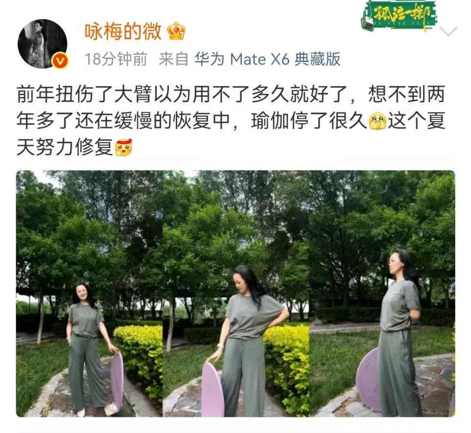 咏梅大臂扭伤两年仍在恢复中咏梅自曝仍在恢复前年旧伤咏梅大臂扭伤两年仍在恢复中 