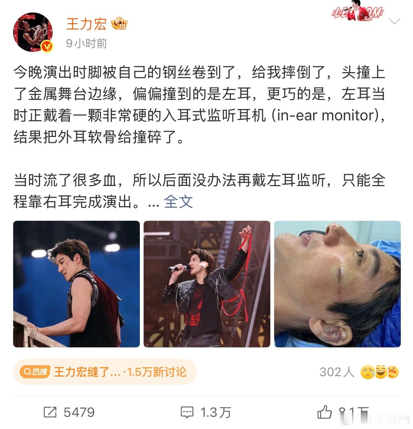王力宏缝了39针摔得这么严重，还坚持唱完整场演唱会，二哥对歌迷真的是太宠爱了，虽