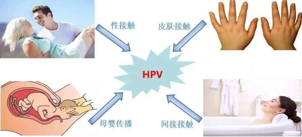 长三角大学健康护航行动:关注HPV科普，携手共建健康防线，加快消除宫颈癌

今年