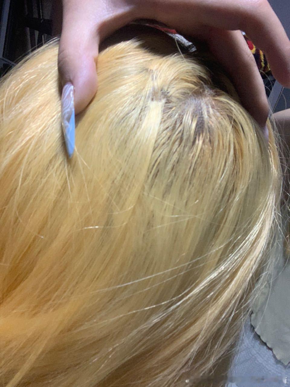 【带图】这是怎么回事啊 昨天去漂头发了 最后染发根的时候头皮灼烧感很严重 没几分