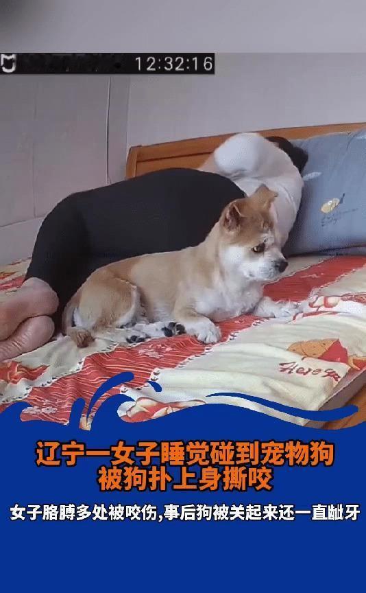 辽宁一女子因养狗不栓绳，午休时被自家两只狗咬伤胳膊。幸好没有毁容，但这件事在网上