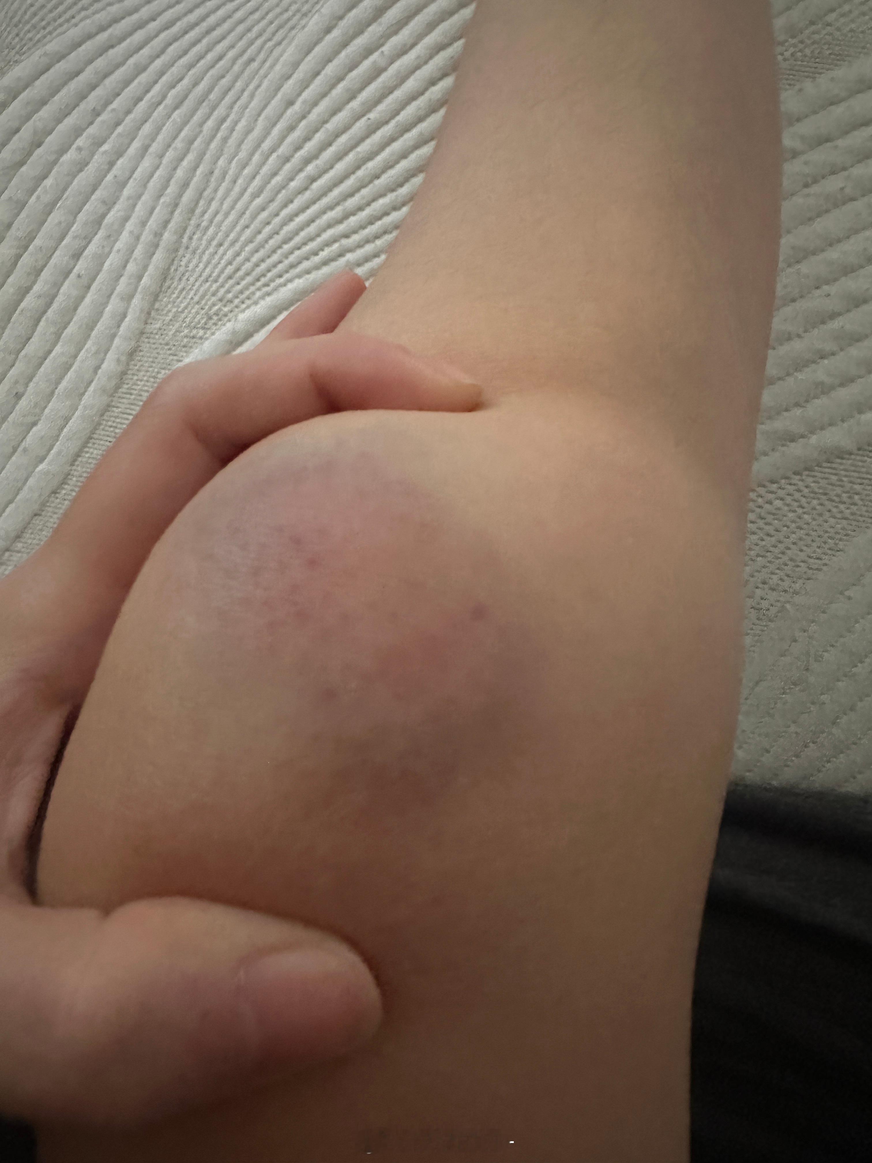 怎么又摔了雨欣