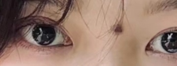 处于印堂与山根的痣，对女性影响更大的是婚姻感情，对男性影响大的是事业与婚姻感情，