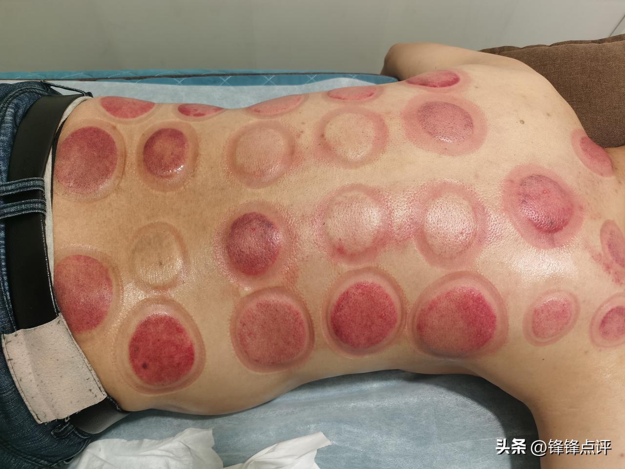 哈哈，感觉还挺不错！
原本以为自己感冒了，昨天去诊所挂了盐水，本以为能好，结果今