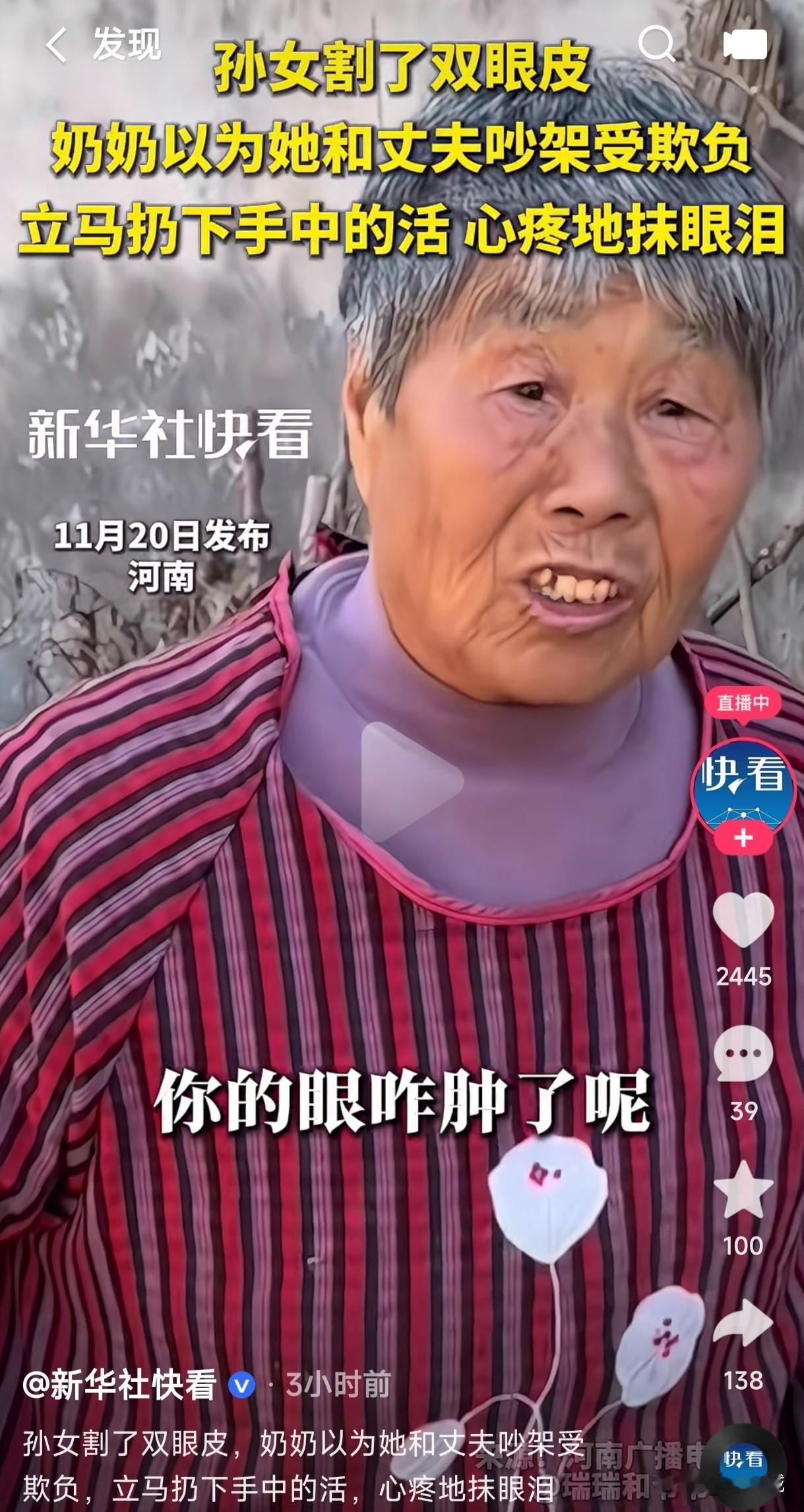 孙女刚割了双眼皮，两个眼睛肿的通红，奶奶以为她和丈夫吵架被欺负了，立马放下手中的