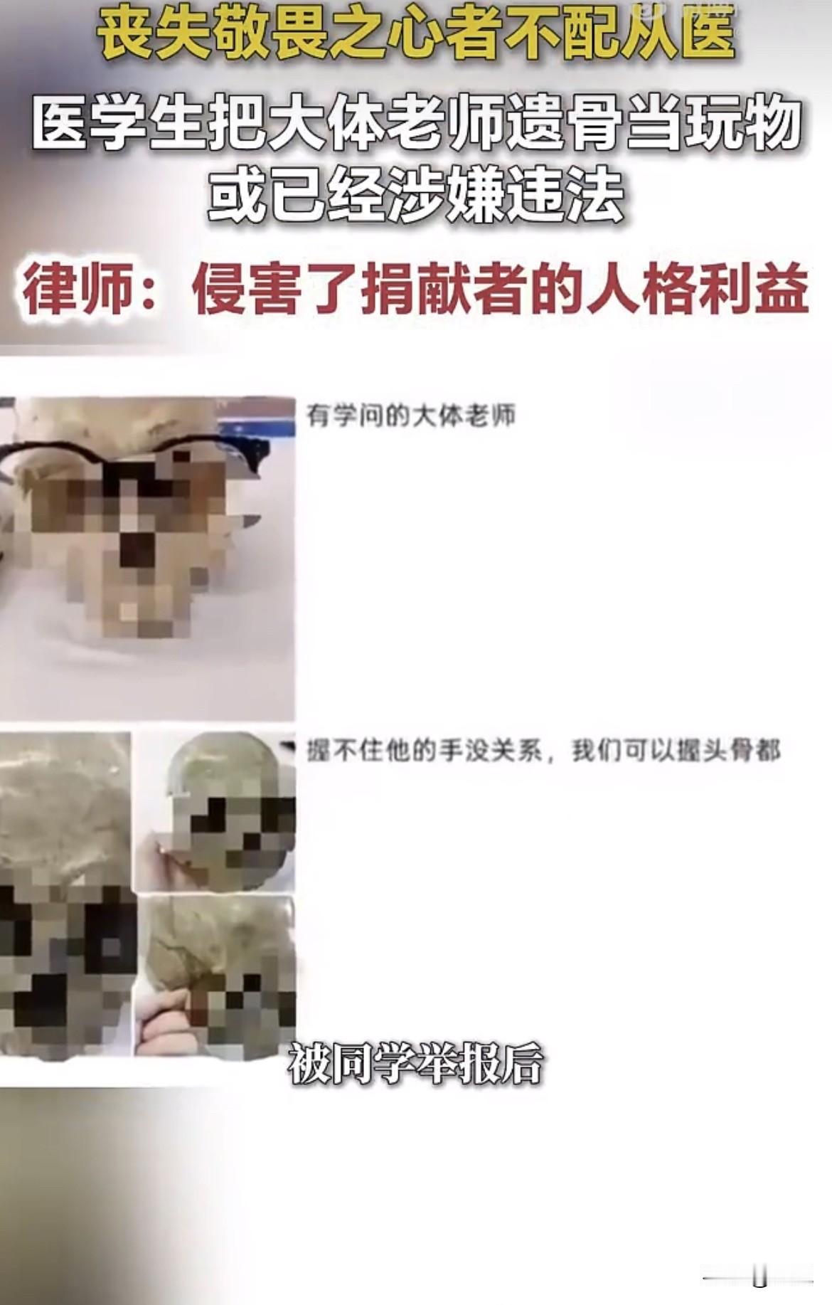 一个遗体捐献登记者看到那张头骨戴眼镜的照片后说，“本来寻思人没了做点贡献，现在看