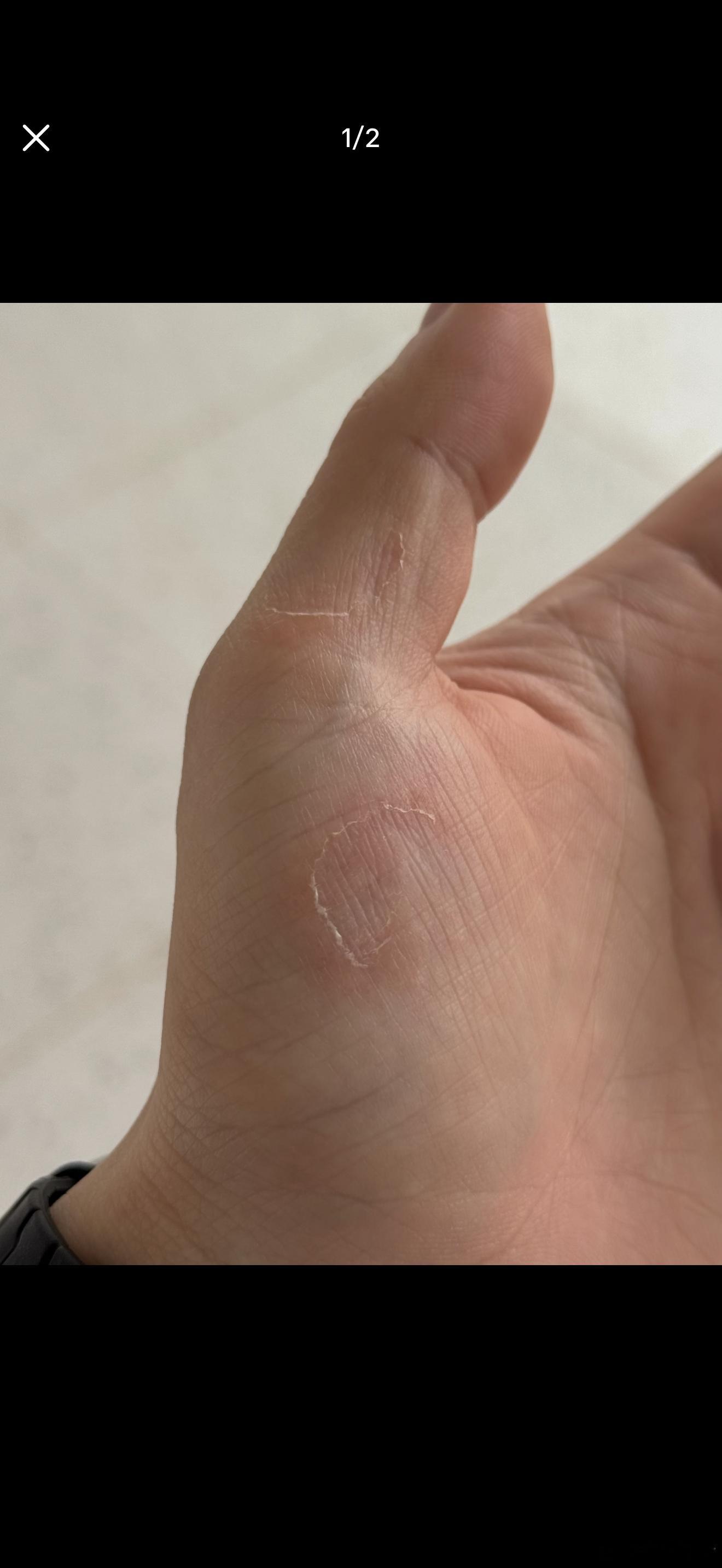 去健身房真的别偷懒上周朋友跟我说了个真实经历：她在健身房摸完金属铁片器械，没洗手