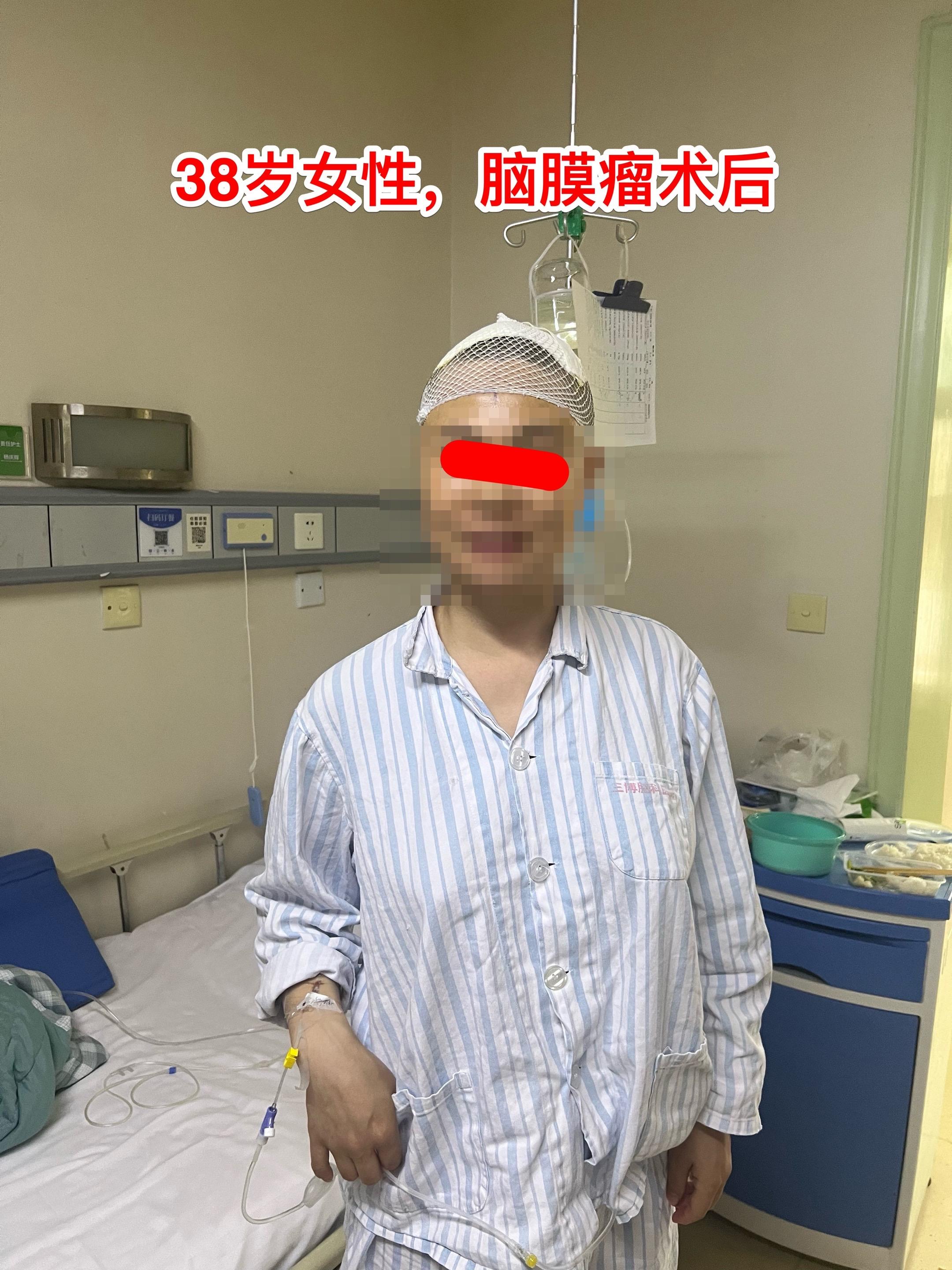 脑膜瘤的病理诊断—-需要格外关注。绝大多数的脑膜瘤都是良性肿瘤，小部分...