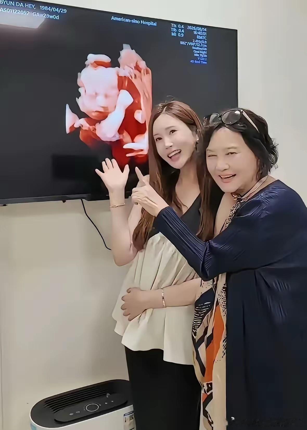 上海产检室里，李多海妈妈望着屏幕中的宝宝影像喜极而泣——这个小生命，一家人盼了太