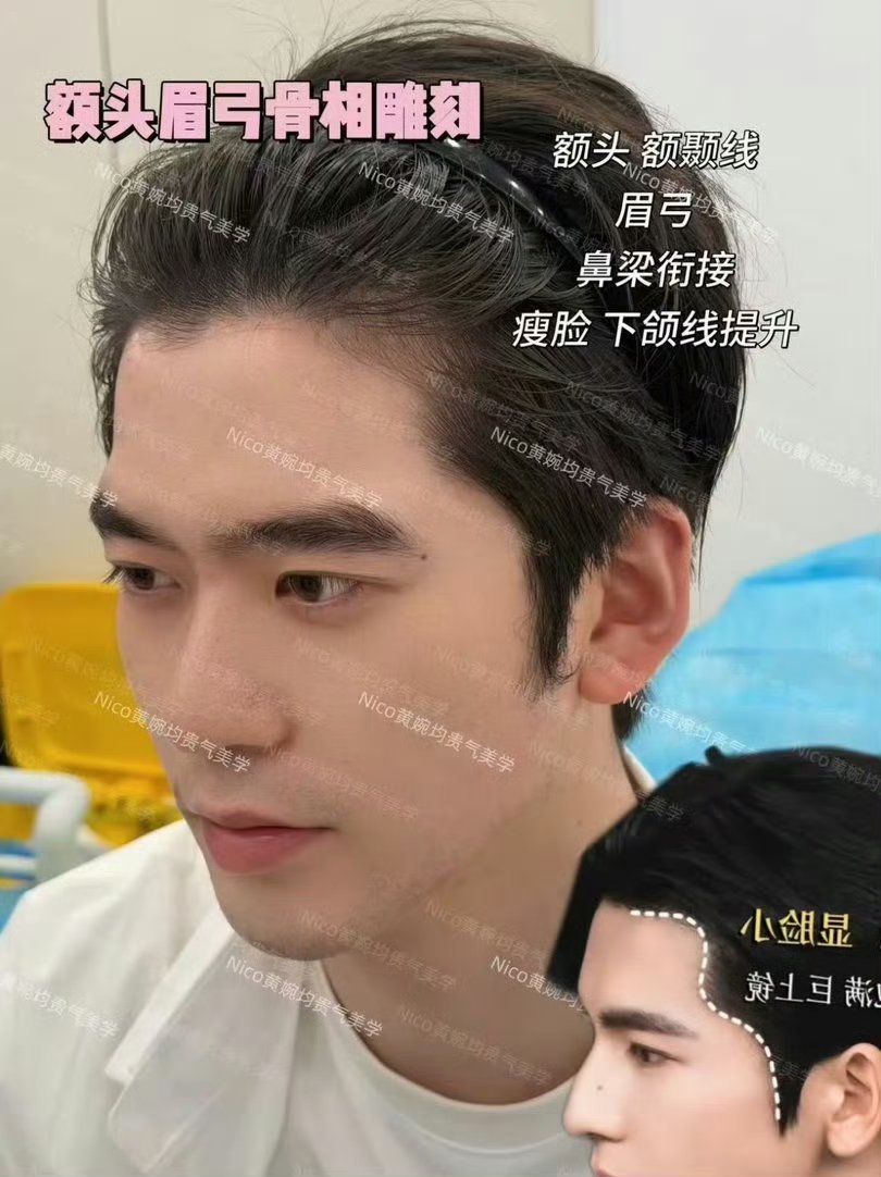赵樱子弟弟整成张凌赫了我的妈呀大哥也是整上了 