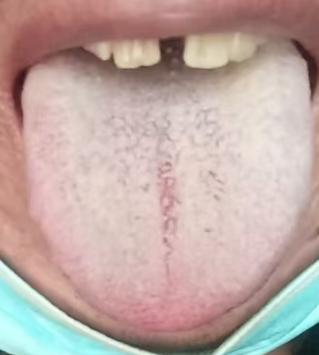 房事时长不如意，分清体质调理才对症






很多朋友年纪轻轻就出现了房事时长