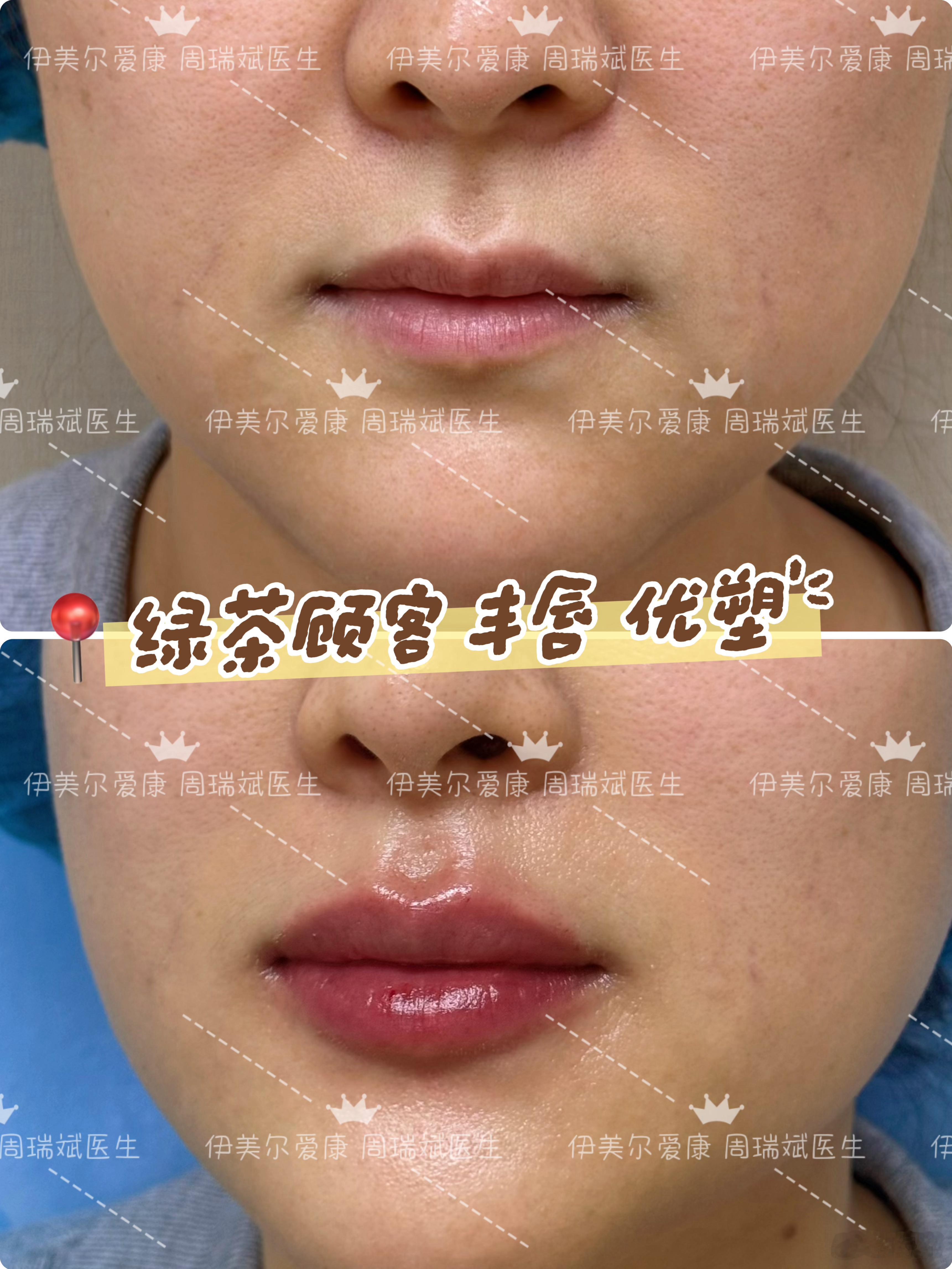 🤏个👄吧  太美了 北京·伊美尔爱康医院