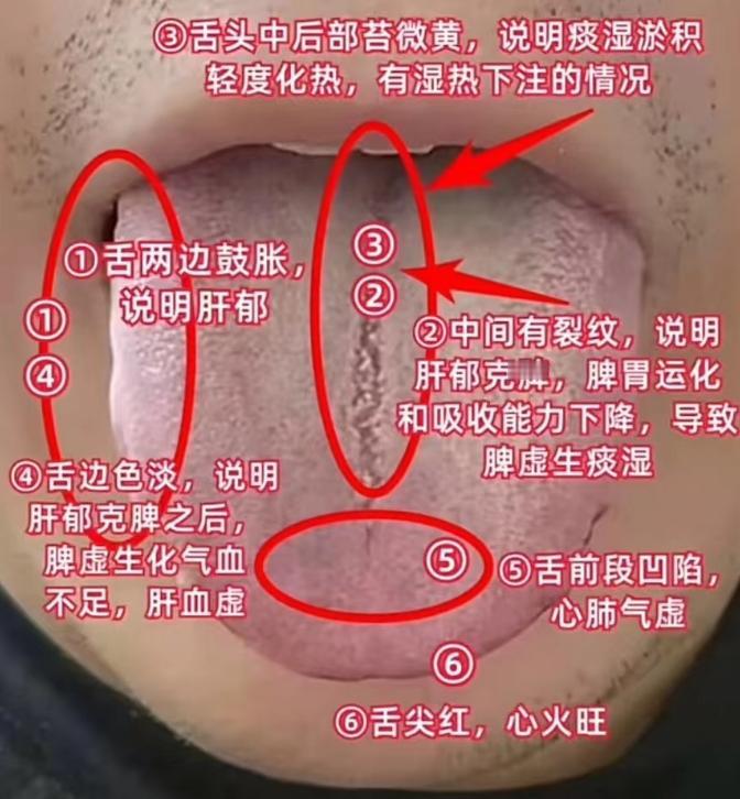 应粉丝要求，从今往后每天都给大家免费分析舌象！

你拍我看，现场分析，及时出结果