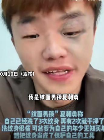 有个小伙，满脸纹身曾让他觉得超酷，现在却宁愿疼到攥紧拳头，也非要把这些纹身一点点