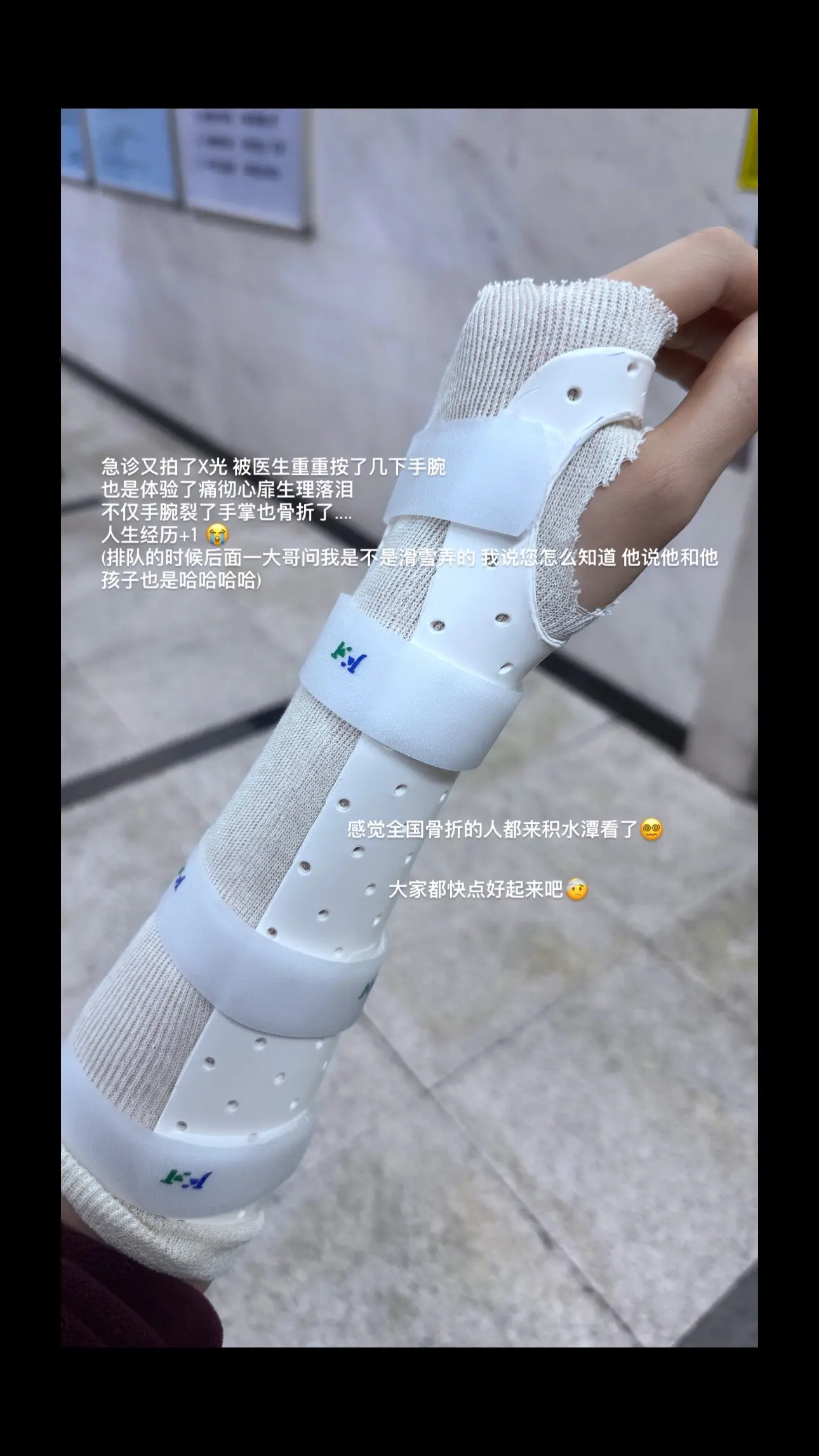 觉得手戳到就赶快去医院拍片子 我整整耽误了两天什么措施都没采取 导致更...