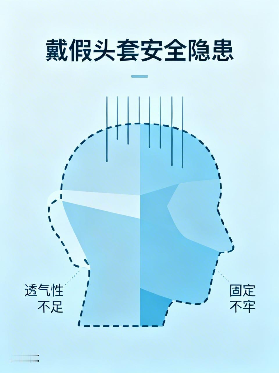戴假头套有哪些安全隐患 戴假头套看似能快速改变造型，但存在不少安全隐患。就材质来