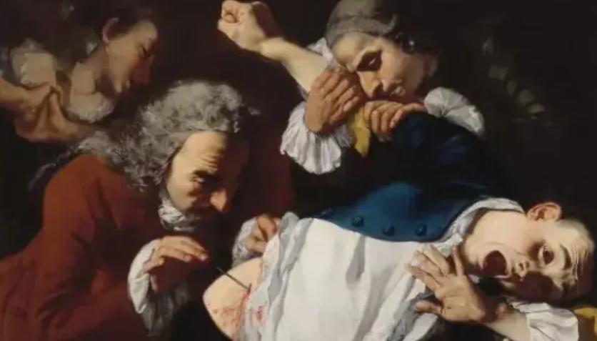 1799年，67岁的美国总统华盛顿奄奄一息的被两位医生死死按在手术台，他们用刀接