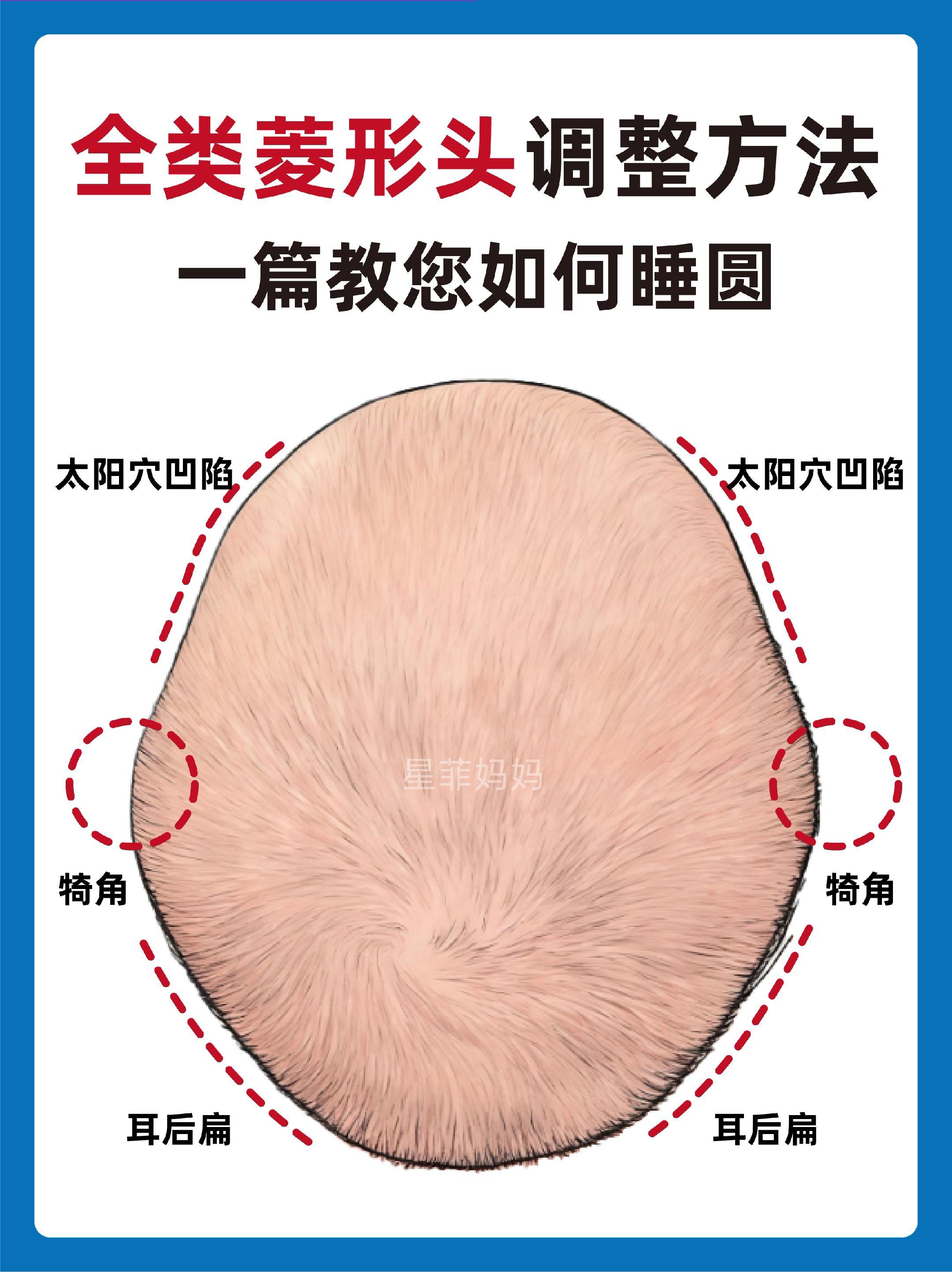 全类型菱形头一次讲清楚|再也不用求人。