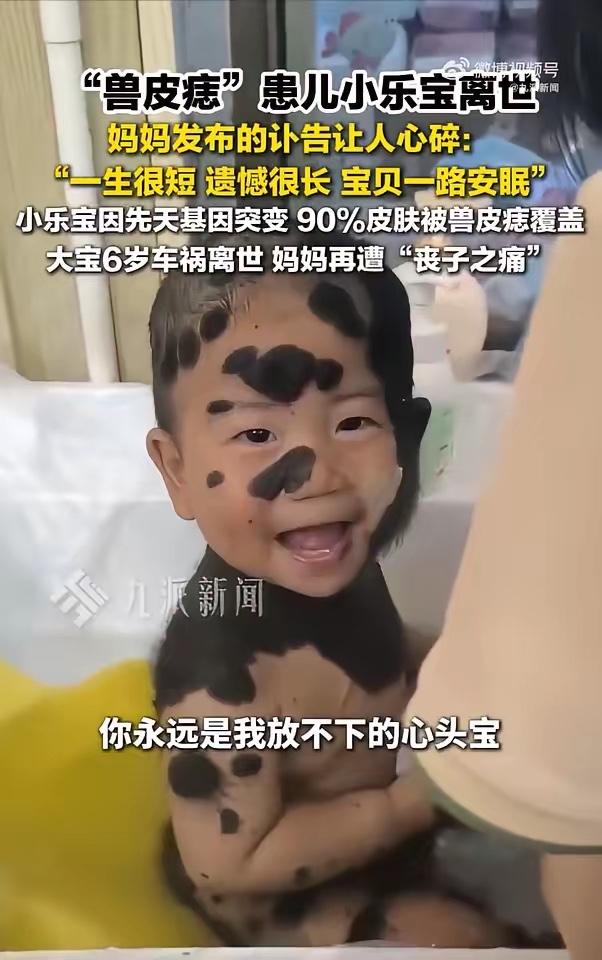 6月13日，备受关注的 “兽皮痣” 患儿乐宝离世，其母亲发布讣告令人心碎。乐宝因