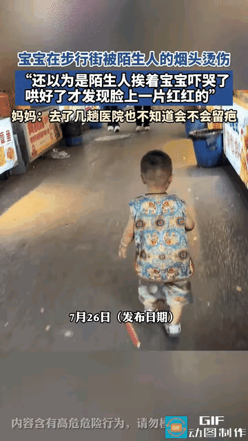 揪心一幕！河南安阳步行街，小男孩脸部被路人手中烟头烫伤，孩子当场痛哭。
事发时小