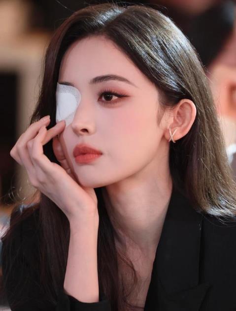 娜扎右眼贴纱布 古力娜扎在线下活动上身穿一身黑色修身西装，右眼贴着医用白色纱布，