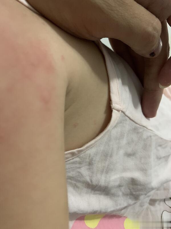 #儿童健康守护者计划##新手爸妈指南# 【儿科病例分享】以下是某咨询平台家长提供