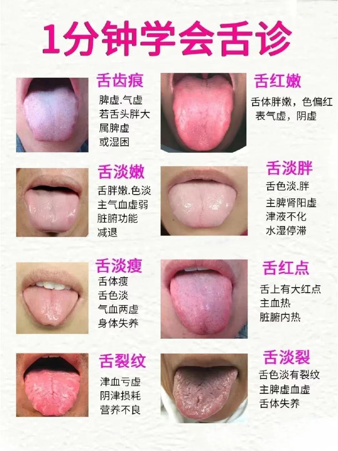 一分钟教你学会舌诊，建议每个人都会学会看看，为自己及家人的身体健康保驾护航[谢谢