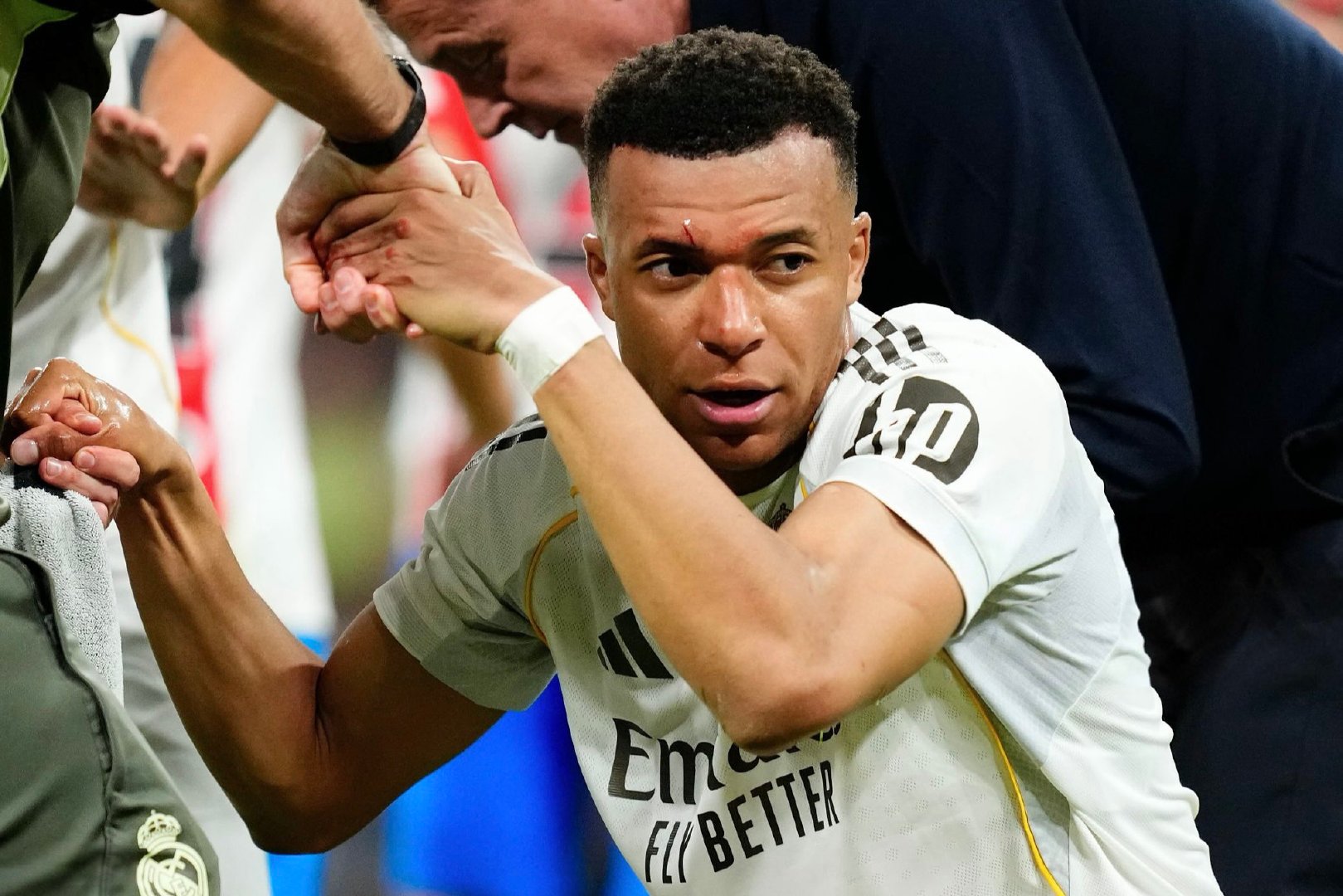 🚨姆巴佩被维托尔·雷斯肘击后眉骨出血。🤕裁判回看录像后，认定对方没有犯规。?