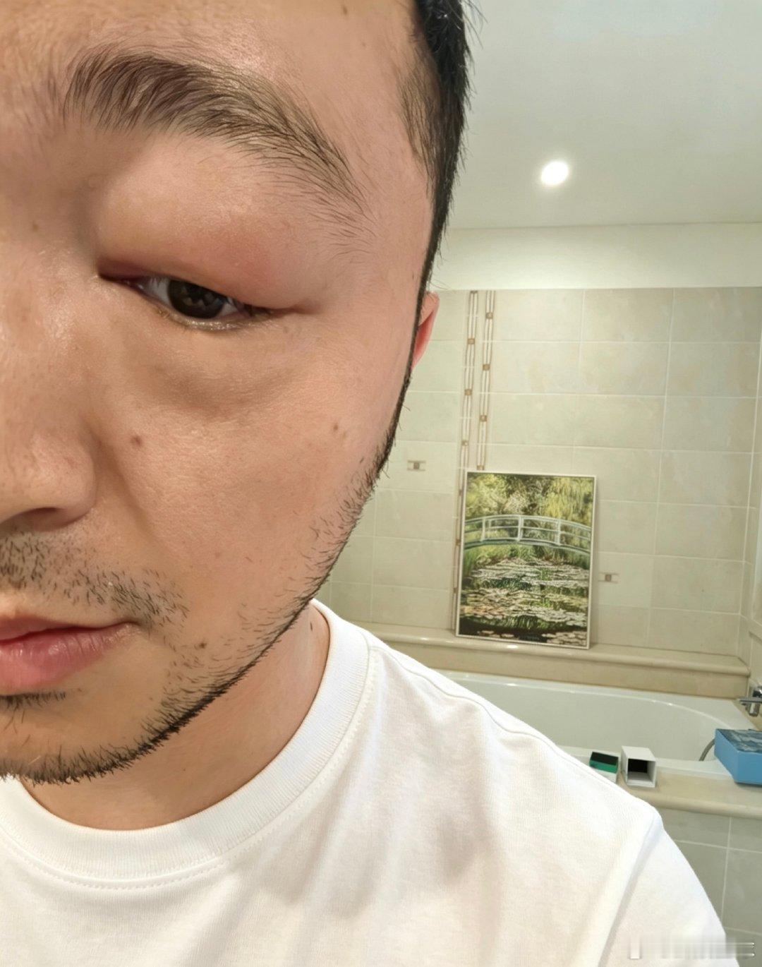 尼格买提变成尼鼓买提了尼格买提染发剂过敏尼格买提染发剂过敏尼格买提别染发