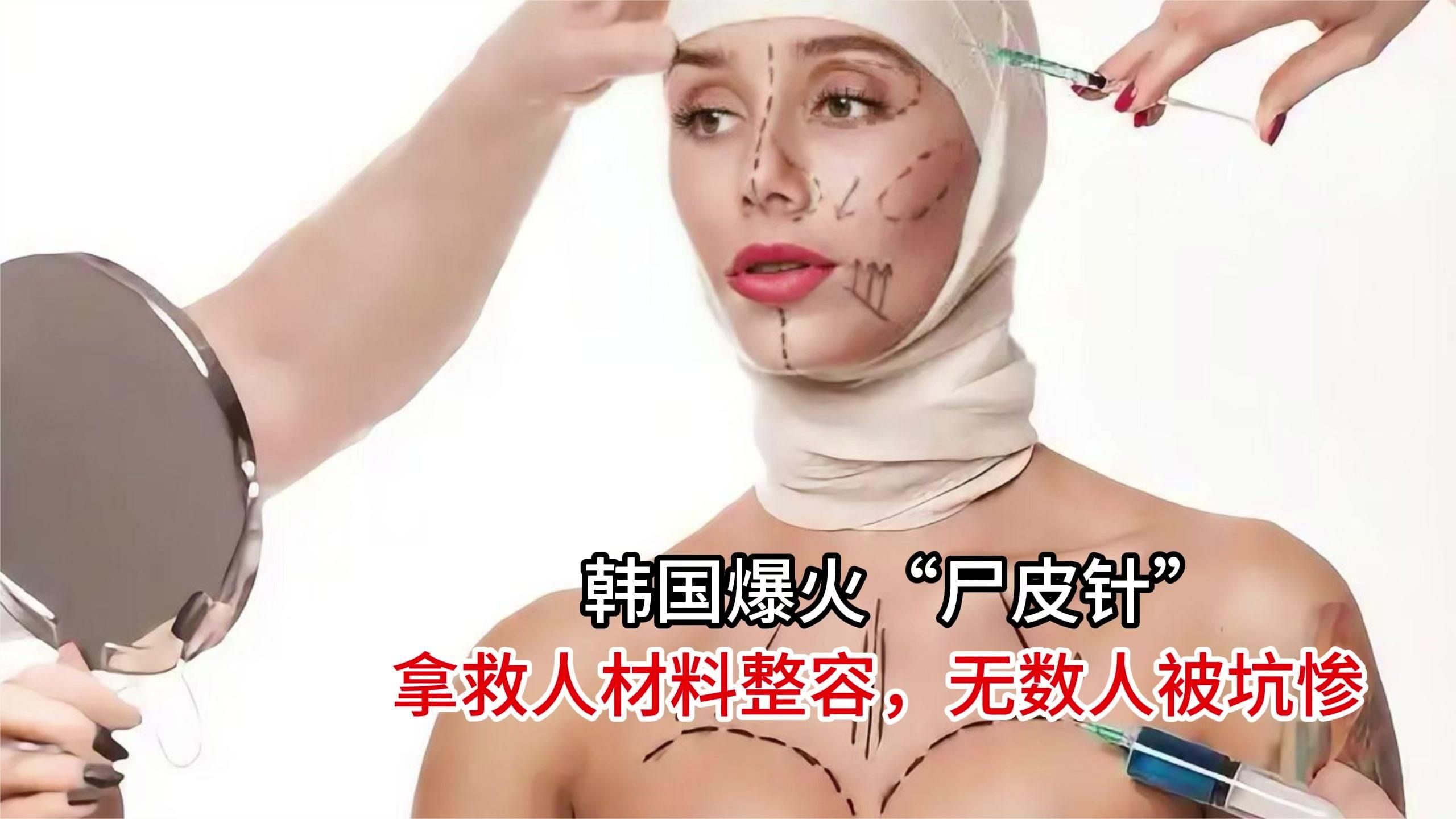致命医美乱象！韩国爆火尸皮针，拿救人材料整容，无数人被坑惨