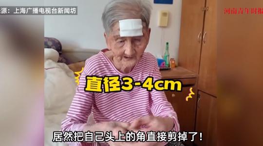 “活久见！”近日，上海，一98岁高龄的老太因为头上长了一个3公分的“犄角”，老太