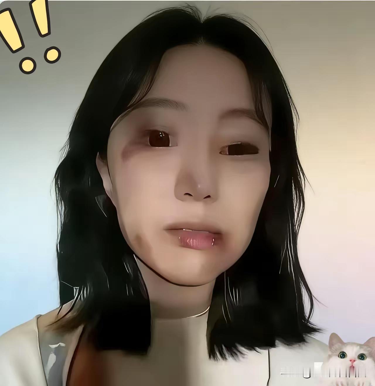 这女子不值得同情，虽然她被打了满脸伤！

江西一女子，到市场去买鱼。挑好鱼后，提