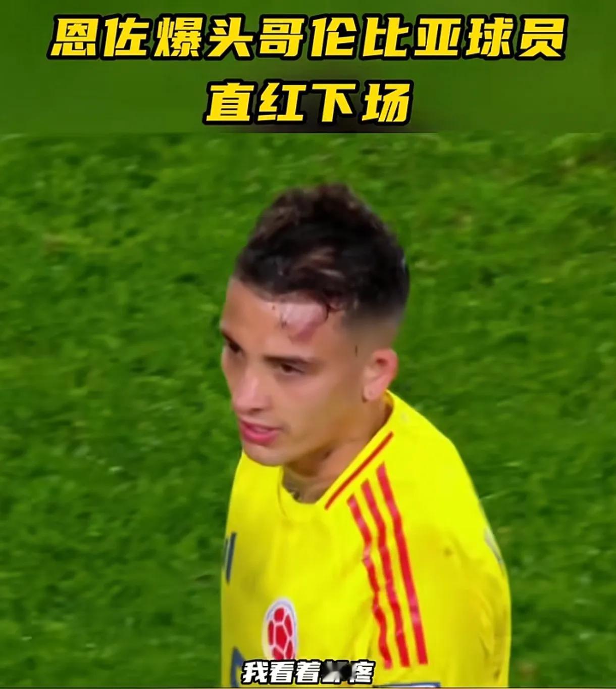 恩佐这脚也太坏了，给哥伦比亚球员脑袋上踢出了个馒头大的鼓包！
南美球员素来以彪悍