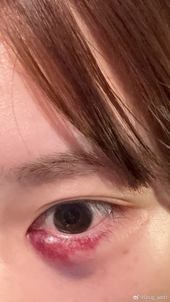 嗯嗯嗯嗯嗯…11月你对我很差 ​​​