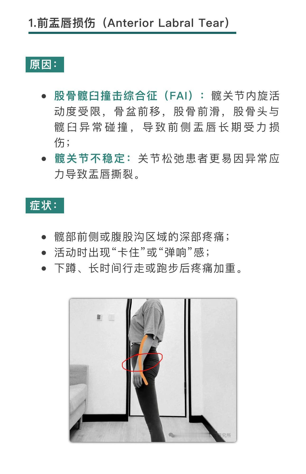 运动康复 【髋关节盂唇损伤——四种分型+康复】髋关节盂唇损伤的朋友，除了遭受疼痛